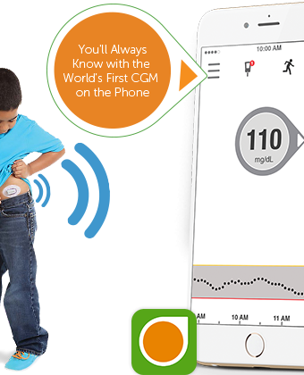 Piąta generacja CGM Dexcoma