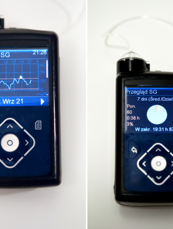 Przegląd odczytów z sensora w pompie Minimed 640G